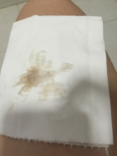 试管婴儿移植成功后该如何保胎？(移植后保胎最佳时间）