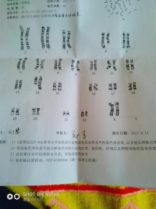 试管婴儿染色体异常的几率大吗(生化染色体异常的几率大吗）