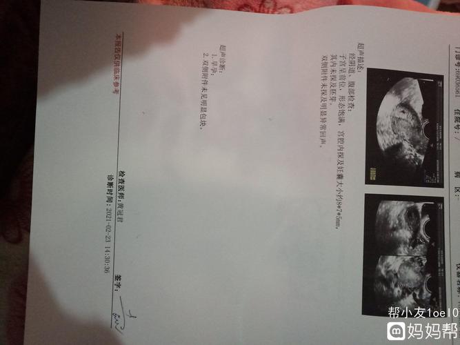 阴超检查什么时候做最好？(怀孕多久做阴超可以检查出来）