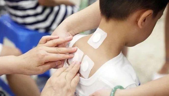 贴三伏贴可以喝可乐吗(贴三伏贴吃了冷饮怎么办)