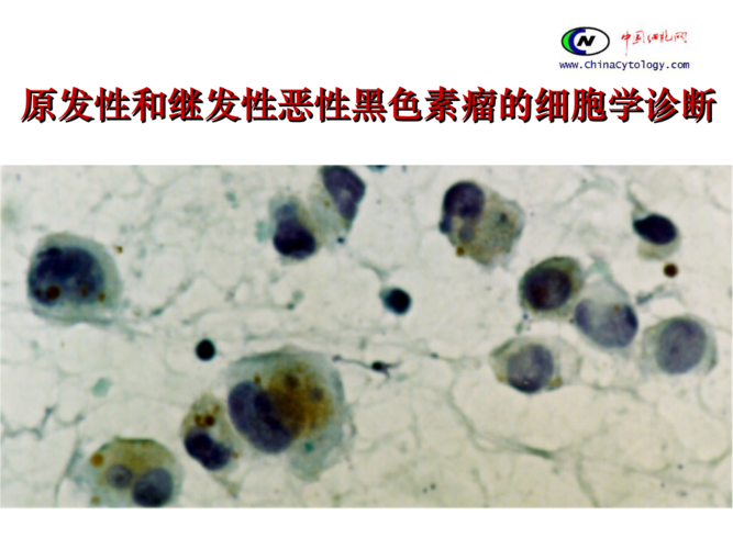雌二醇低可以吃蜂王浆吗(六项激素其他都正常雌二醇低）