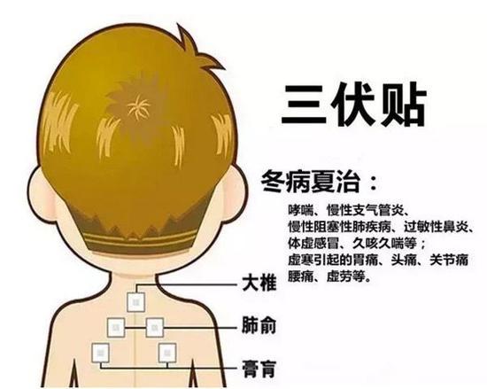 贴三伏贴能去体内湿气吗(儿童贴三伏贴有用吗）
