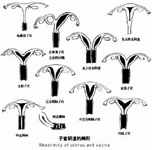 通水可以疏通输卵管吗(输卵管一般要通几次）