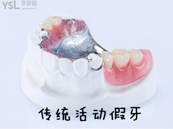 镶牙当月可以怀孕吗(镶牙多久后才能跟正常牙一样使用）