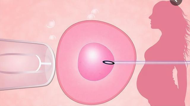 试管取卵后腹水感觉如何(取卵后腹水是什么感觉)
