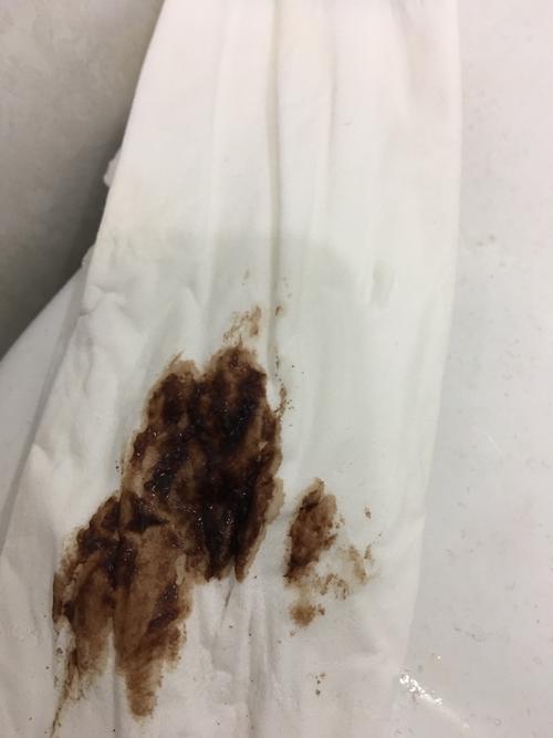 非经期出血褐色超过7天是怎么回事(月经前5-8天有褐色分泌物）