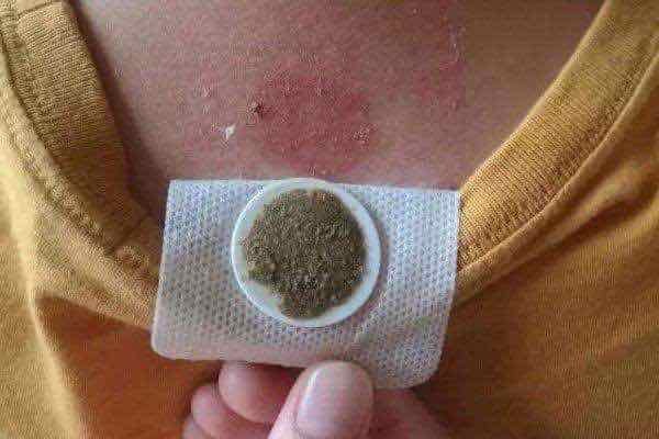 贴三伏贴可以吃鱼吗(三伏贴忌口食物一览表）