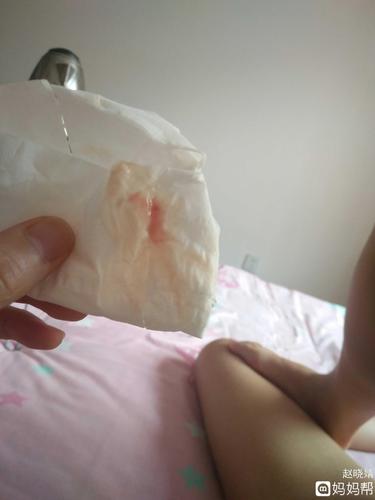 这次月经量少是怀孕吗(怀孕9周突然流鲜血像月经）