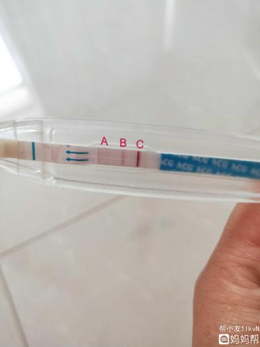 验孕棒三道杠怎么回事(早孕试纸三条杠）