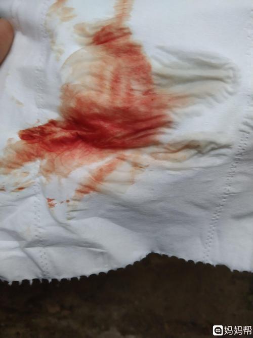 非月经期出血的原因(非经期突然有少量出血）