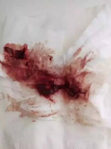 验孕棒准确率高吗(15个信号暗示你怀孕了）