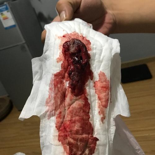 闭经同房会怀孕么(女人月经过后什么时候容易怀孕）