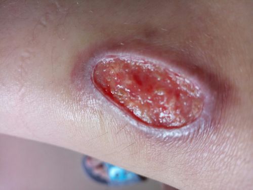 顺产55天会怀孕吗(顺产36天可以同房了吗）