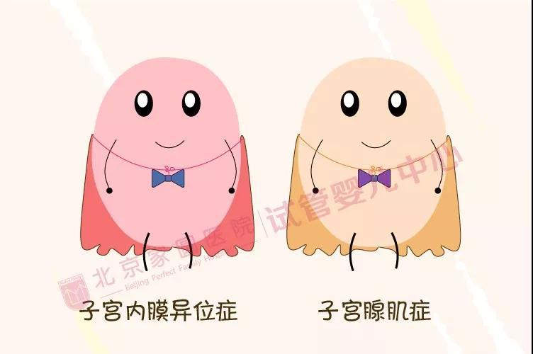 腺肌症和子宫内膜异位症的区别(腺肌症时间久了会怎么样）