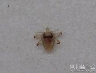 阴虱要看什么科室去医院不要搞错科室(阴虱怎么来的）