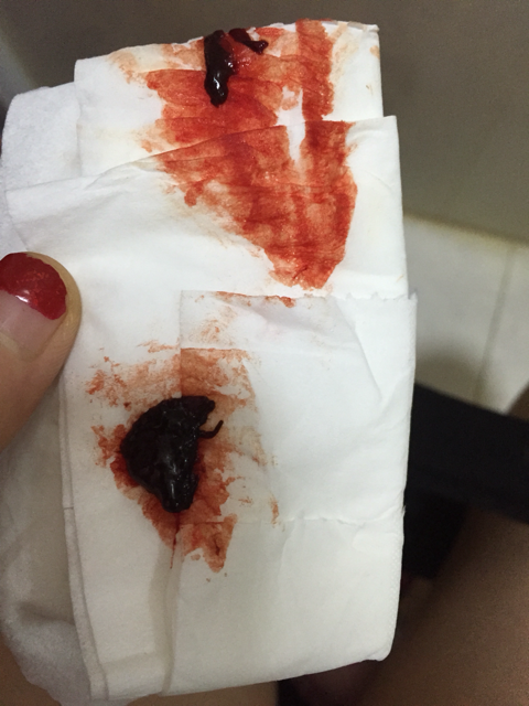 这次月经量少是怀孕吗(怀孕9周突然流鲜血像月经）