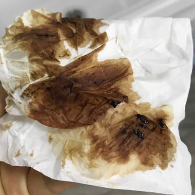 非经期有少量出血褐色是怎么回事(没来月经但是有褐色血）