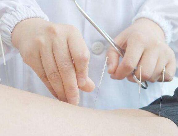 针灸真能帮助怀孕吗(针灸对备孕有什么好处)