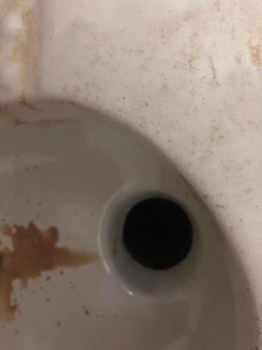 同房后出现豆腐渣咋回事