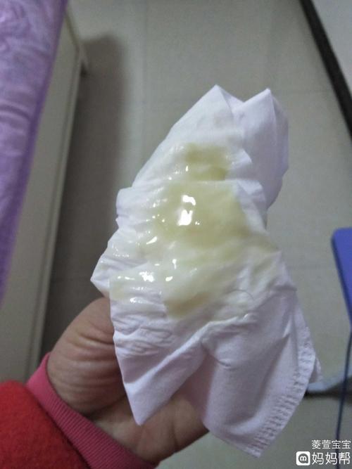 闭经和怀孕的区别(白带什么样说明怀孕了）