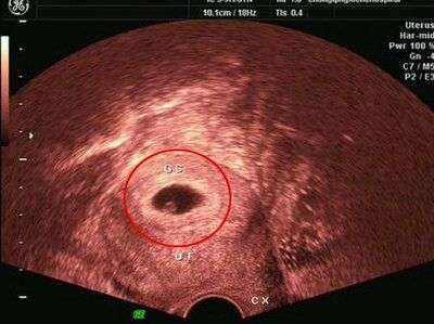同房2个月没怀孕正常吗(要了两个月孩子没怀上什么原因）