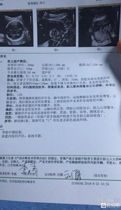 凶险性前置胎盘什么时候最危险(胎盘血池孕妇要注意什么)