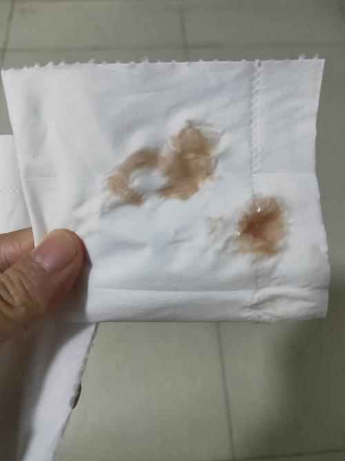 什么人容易排卵期出血(排卵期出血4大症状）