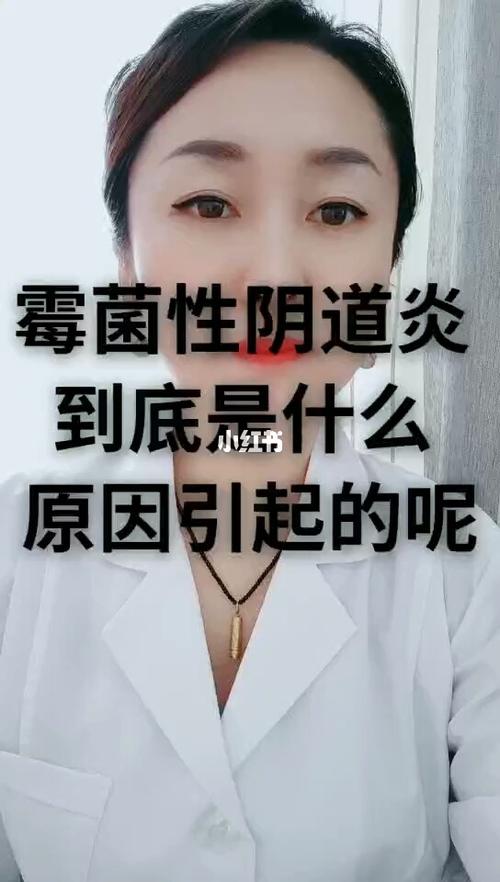 分泌物像豆腐渣用什么药(什么是白带正常图片)