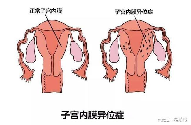 试管婴儿是怎么回事做试管婴儿对女性来说有多痛苦(做试管婴儿是不是很痛苦）
