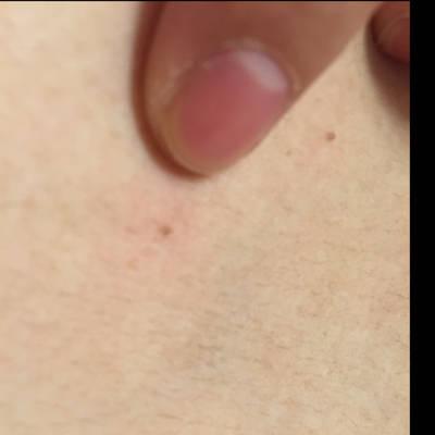 做瓷托槽可以怀孕吗(怀孕身上的肉瓷实了好吗）