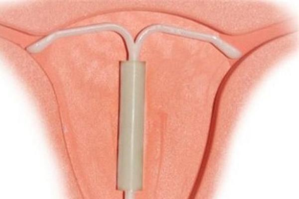 取环后一般多久可以怀孕取环对怀孕有影响吗？(什么时候取环最合适）