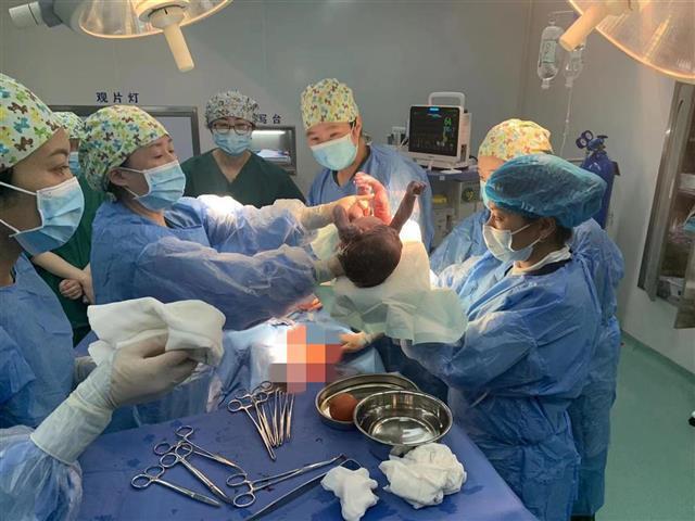 剖腹产十个月会怀孕吗(剖腹产后13个月怀孕可以要吗）