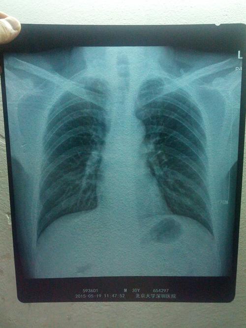 做过ct多久不可以备孕(拍完ct多久可以怀孕)