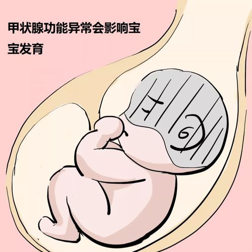 亚临床甲减可以怀孕吗(桥本甲减怀孕对胎儿的影响大吗)