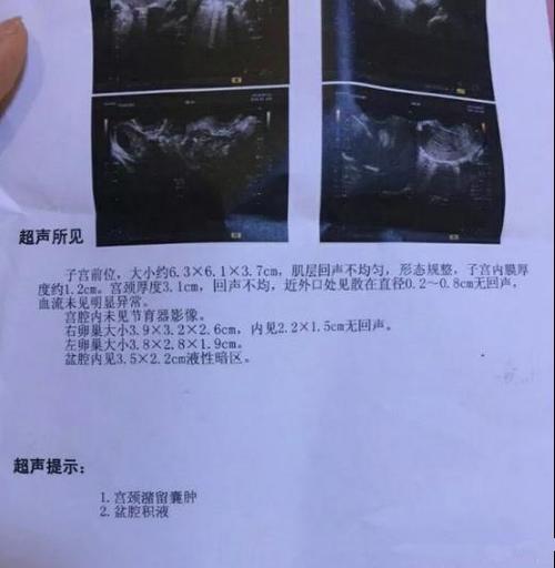 做b超监测排卵易怀孕吗(排卵后怀孕初细微感觉)