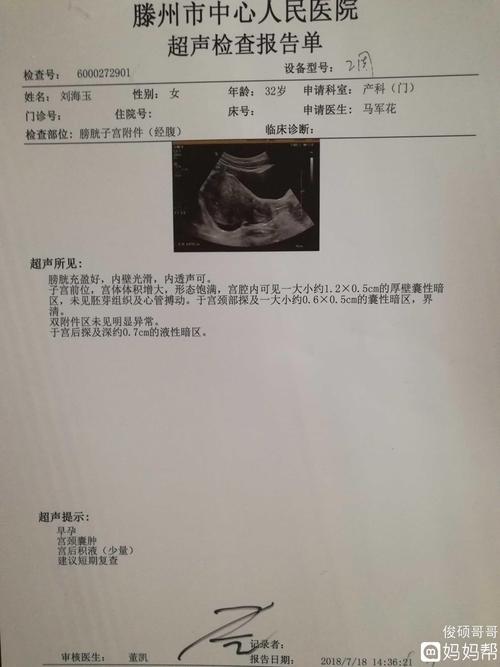 做了彩超多久可以怀孕(做彩超影响备孕吗)