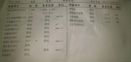 前列腺液会不会传染艾滋病毒一定要小心hiv！(前列腺液感染hiv）