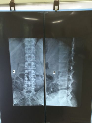 做x胸片多久可以怀孕(拍片子后多久可以怀孕）