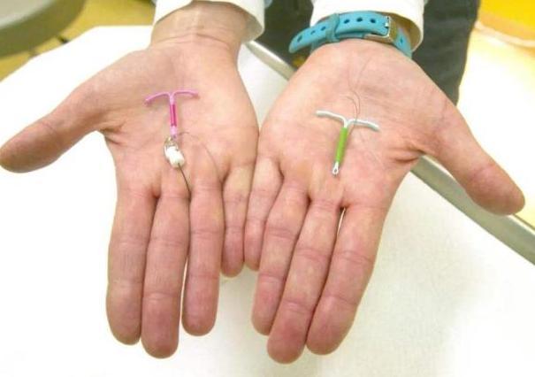 取环后一般多久可以怀孕取环对怀孕有影响吗？(什么时候取环最合适）