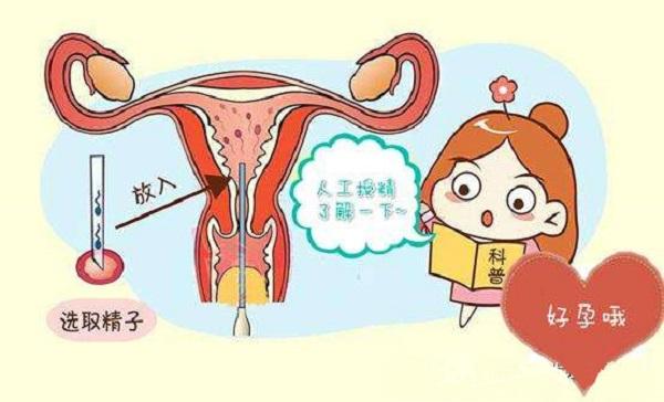 人工受孕失败的原因(人工受孕失败多久可以再做）