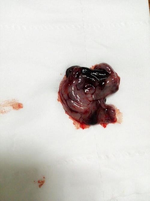 做了6个检查再怀孕生出来的宝宝都很健康!(孕检都过了胎儿是不是就是没问题)
