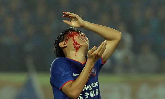 什么人容易排卵期出血(排卵期出血4大症状）