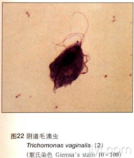 医院孕前查体哪些项目(孕前查体包括哪些项目）