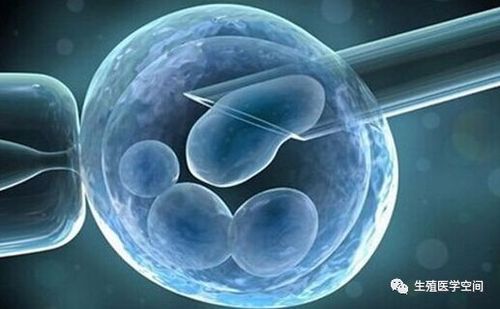 试管婴儿是怎么回事做试管婴儿对女性来说有多痛苦(做试管婴儿是不是很痛苦）