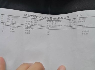 前列腺液什么颜色正常这个颜色才是正常的！(正常前列腺液中见不到）