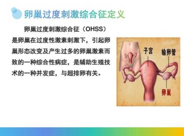 卵巢过度刺激综合征是什么原因引起的(卵巢过激综合症)