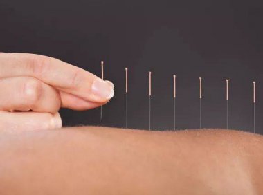 针灸真能帮助怀孕吗(针灸对备孕有什么好处)