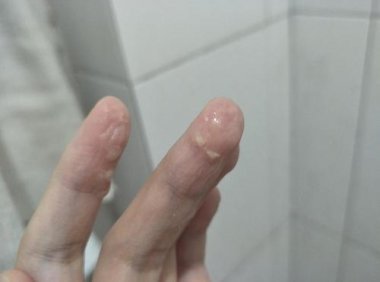 豆腐渣白带是怀孕了吗(同房后出现豆腐渣咋回事）