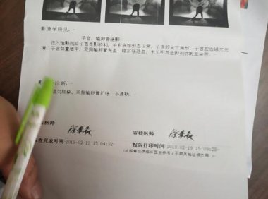 输卵管伞端粘连怎么治效果好(输卵管远端粘连如何治疗）