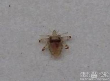 阴虱要看什么科室去医院不要搞错科室(阴虱怎么来的)